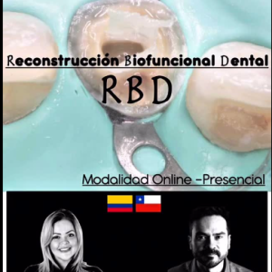 Restauraciones Posteriores Biofuncionales