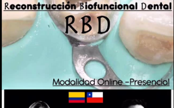 Restauraciones Posteriores Biofuncionales